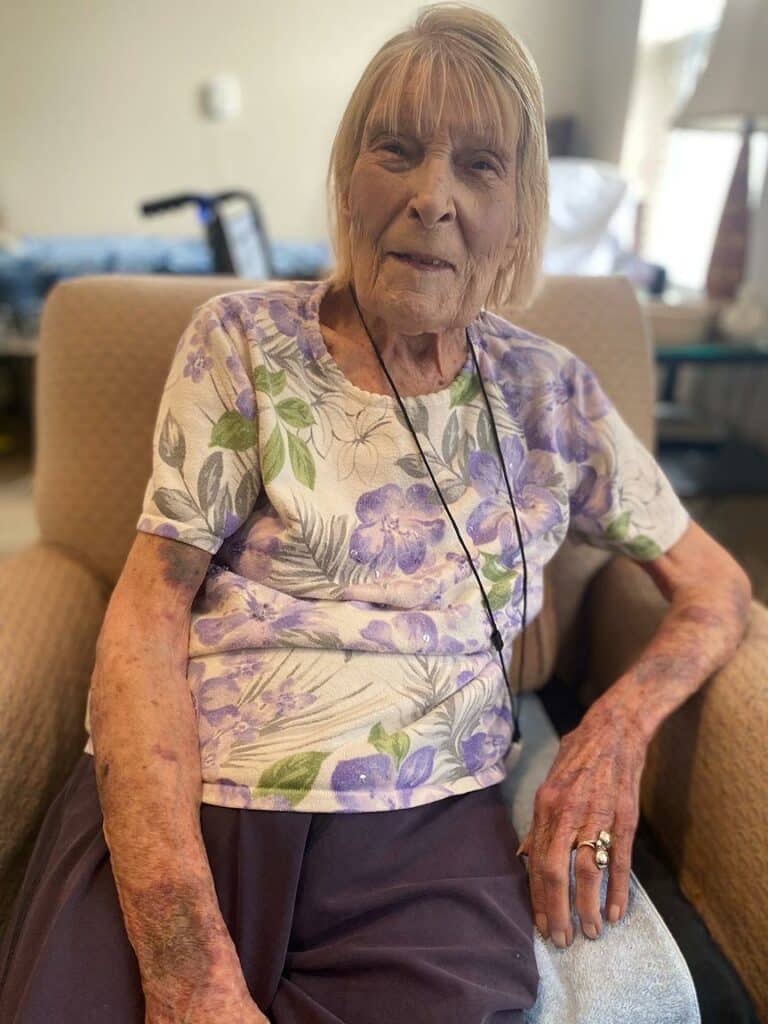 Glenwood Village of Overland Park | Elouise sitting on the couch smiling